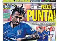 ¡Con los pelos de punta!