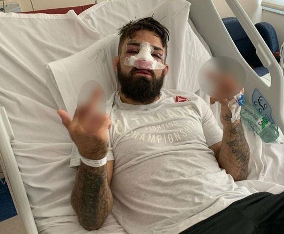 Así quedó Mike Perry luego del UFC Uruguay. (Twitter)